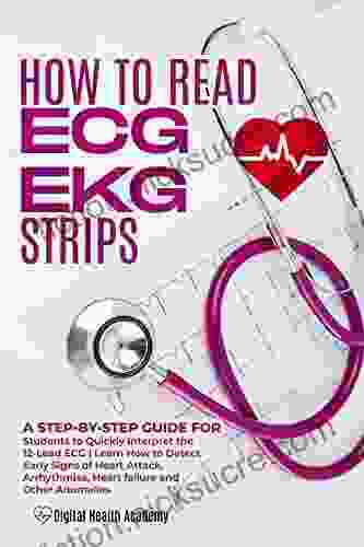 How To Read EKG/ECG Strips: A Step By Step Guide For Students To Quickly Interpret The 12 Lead ECG Learn How To Detect Early Signs Of Heart Attack Arrhythmias Heart Failure And Other Anomalies